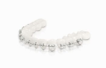 3M Unitek Clarity Self Ligating Ceramic Brackets