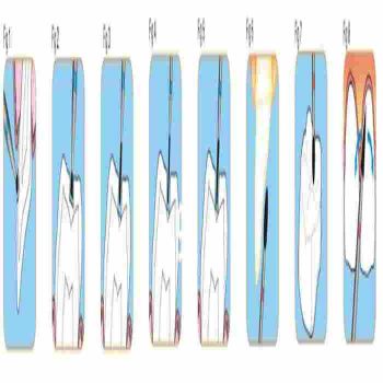 Cross Tech Cavity Preparation Kit
