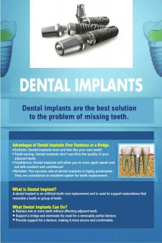 Dental Implants - Dental Poster