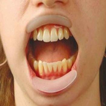 Hager Spandex Lip Retractor Vertical