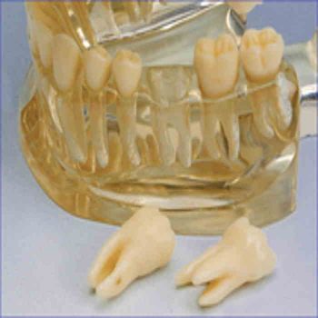Hager Study Model - Transparent