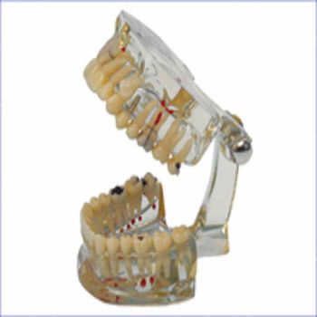 Hager Study Model - Transparent Plus