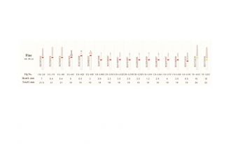 Infri Dental Fine Diamond Bur