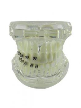 LD Ortho Model With 4 Kinds Of bkts (LD-088)