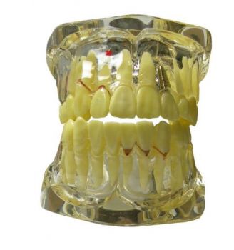 LD Pathologies Model