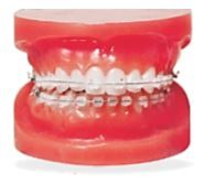 Ortho One Cube Mini Ceramic Brackets